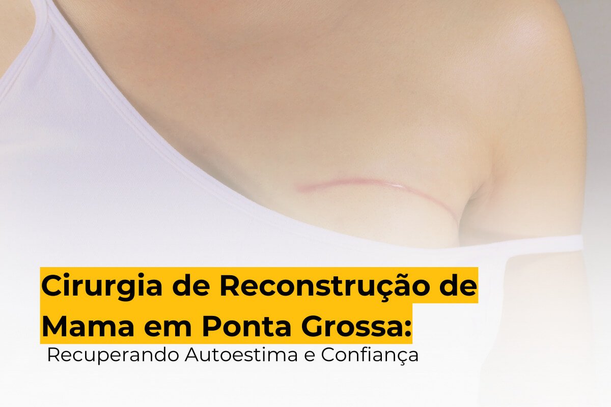 Cirurgia de Reconstrução de Mama em Ponta Grossa: Recuperando Autoestima e Confiança